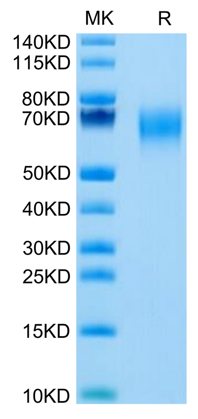 Cynomolgus IL-1 Rrp2/IL-1 R6 on Tris-Bis PAGE under reduced condition. The purity is greater than 95%.Recombinant Cynomolgus IL-1 Rrp2/IL-1 R6 Protein