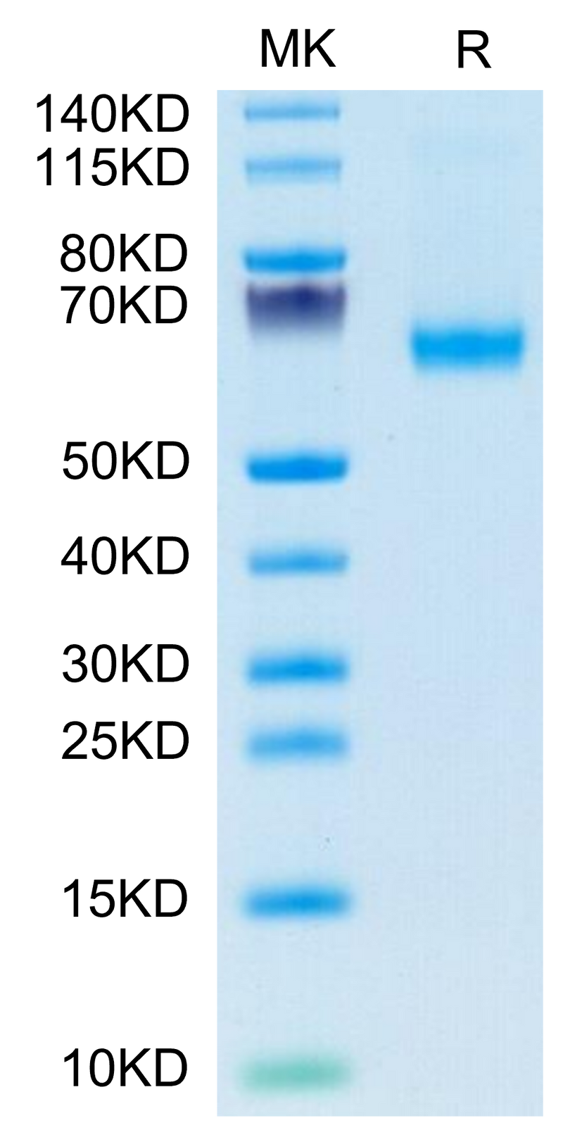 FITC-Labeled Human CD27 Ligand Trimer on Tris-Bis PAGE under reduced condition. The purity is greater than 95%.Recombinant FITC-Labeled Human CD27 Ligand/CD70 Trimer Protein