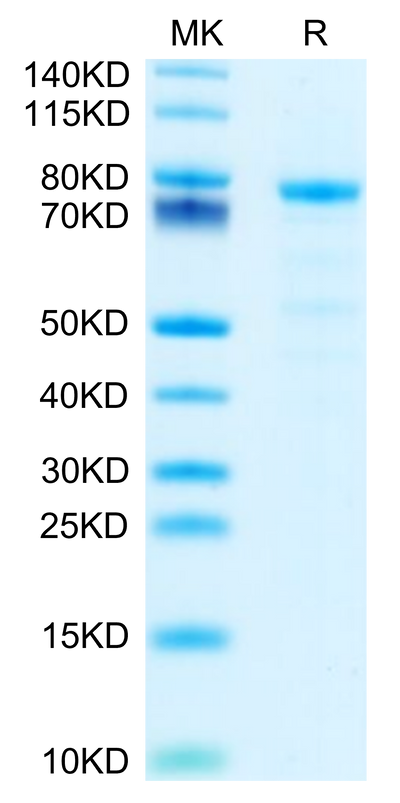 Mouse DSG-2 on Tris-Bis PAGE under reduced condition. The purity is greater than 95%.Recombinant Mouse DSG-2/Desmoglein-2 Protein