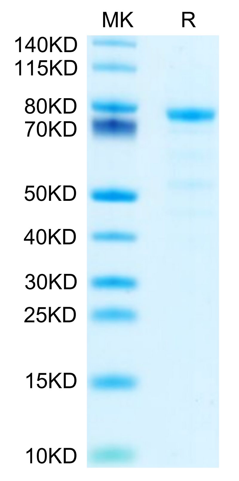 Mouse DSG-2 on Tris-Bis PAGE under reduced condition. The purity is greater than 95%.Recombinant Mouse DSG-2/Desmoglein-2 Protein