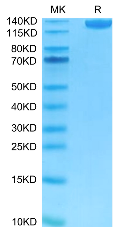 FITC-Labeled Human Siglec-2/CD22 on Tris-Bis PAGE under reduced condition. The purity is greater than 95%.Recombinant FITC-Labeled Human Siglec-2/CD22 Protein