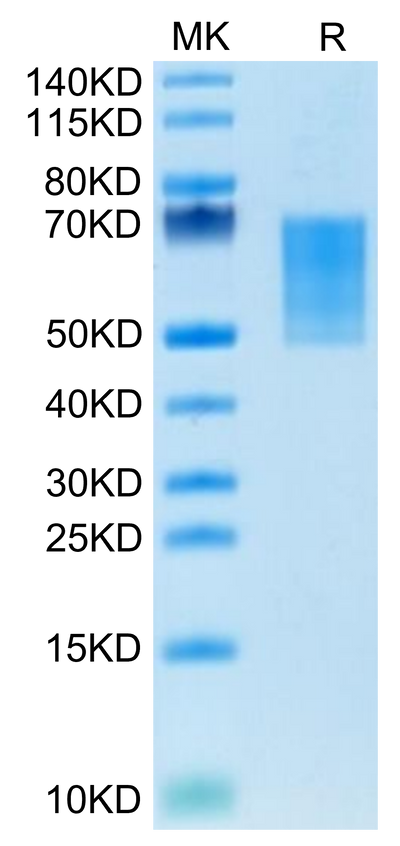 Mouse CD55 on Tris-Bis PAGE under reduced condition. The purity is greater than 95%.Recombinant Mouse CD55 Protein