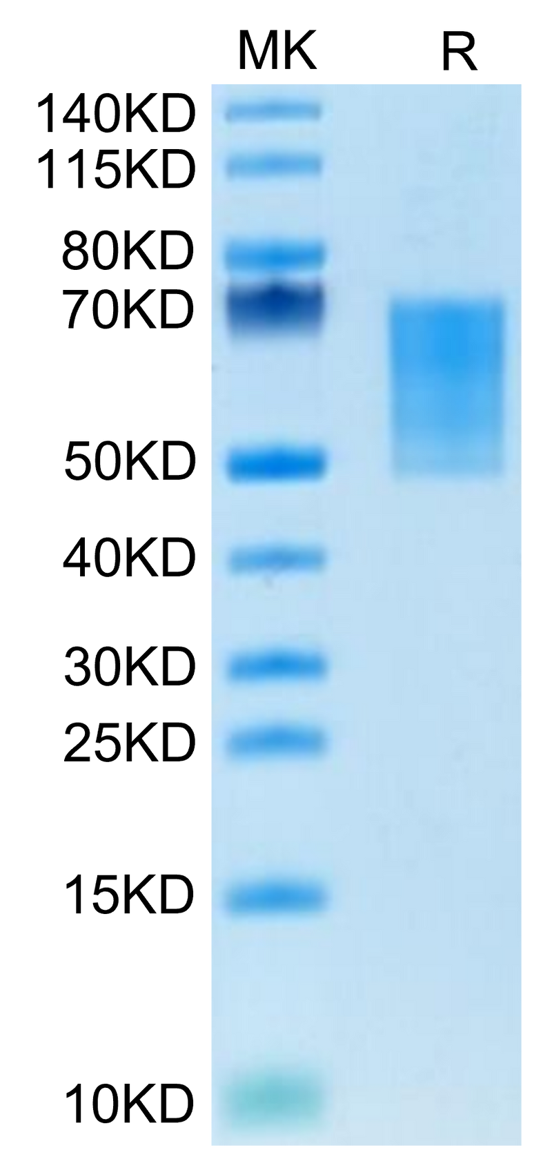 Mouse CD55 on Tris-Bis PAGE under reduced condition. The purity is greater than 95%.Recombinant Mouse CD55 Protein