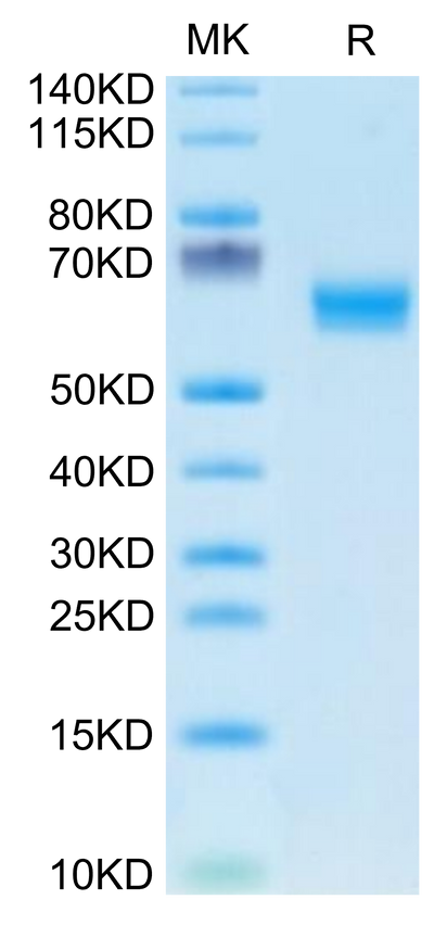 Human DDR1 on Tris-Bis PAGE under reduced condition. The purity is greater than 95%.Recombinant Human DDR1 Protein, Active