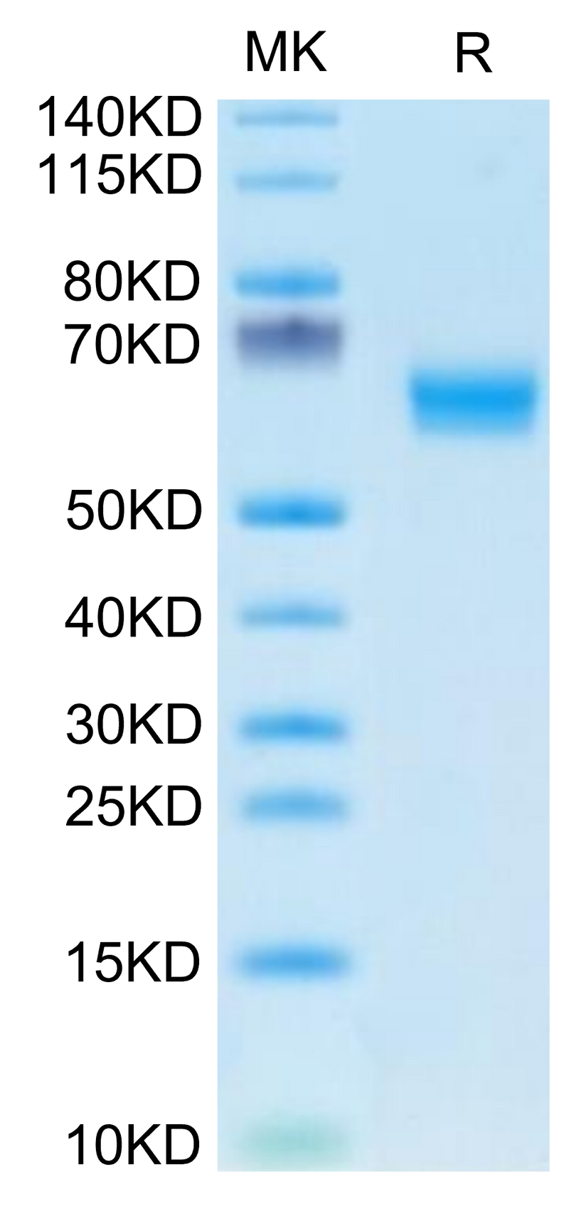 Human DDR1 on Tris-Bis PAGE under reduced condition. The purity is greater than 95%.Recombinant Human DDR1 Protein, Active