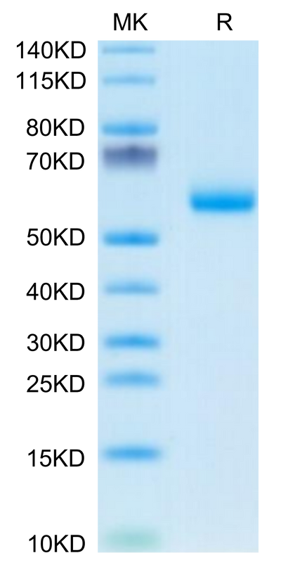 Mouse DDR1 on Tris-Bis PAGE under reduced condition. The purity is greater than 95%.Recombinant Mouse DDR1 Protein