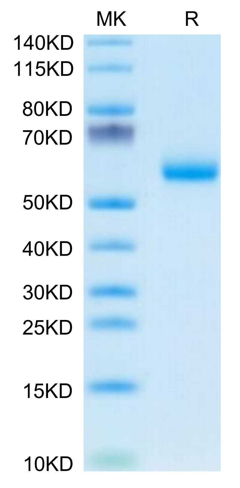 Mouse DDR1 on Tris-Bis PAGE under reduced condition. The purity is greater than 95%.Recombinant Mouse DDR1 Protein