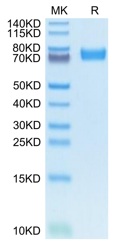 Mouse FcRH5 on Tris-Bis PAGE under reduced condition. The purity is greater than 95%.Recombinant Mouse FcRH5/FcRL5 Protein