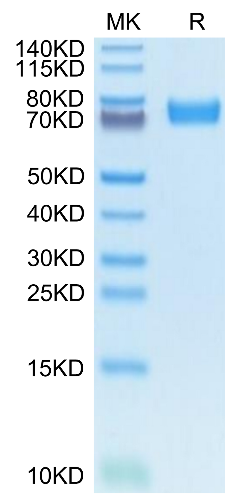 Mouse FcRH5 on Tris-Bis PAGE under reduced condition. The purity is greater than 95%.Recombinant Mouse FcRH5/FcRL5 Protein