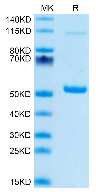 Mouse PGLYRP1 on Tris-Bis PAGE under reduced condition. The purity is greater than 95%.Recombinant Mouse PGLYRP1 Protein