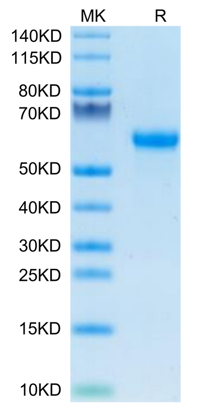 Mouse Factor H/CFH on Tris-Bis PAGE under reduced condition. The purity is greater than 95%.Recombinant Mouse Factor H/CFH Protein