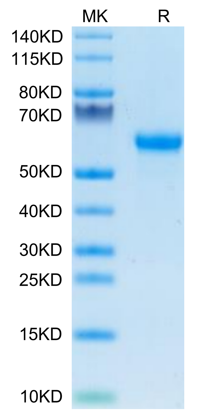 Mouse Factor H/CFH on Tris-Bis PAGE under reduced condition. The purity is greater than 95%.Recombinant Mouse Factor H/CFH Protein