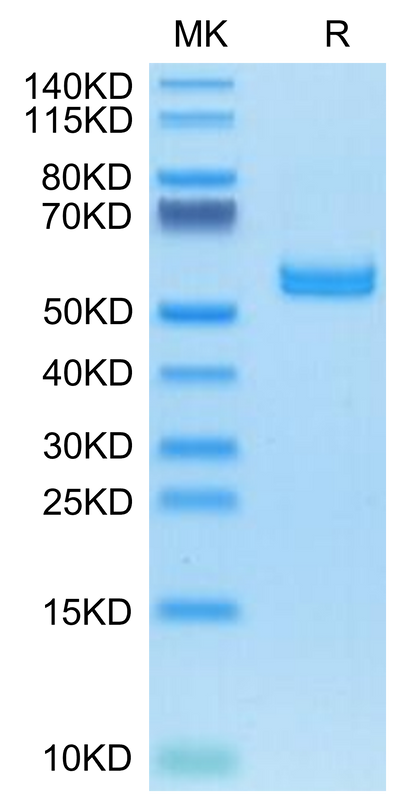 Human AMCase/CHIA on Tris-Bis PAGE under reduced condition. The purity is greater than 95%.Recombinant Human AMCase/CHIA Protein