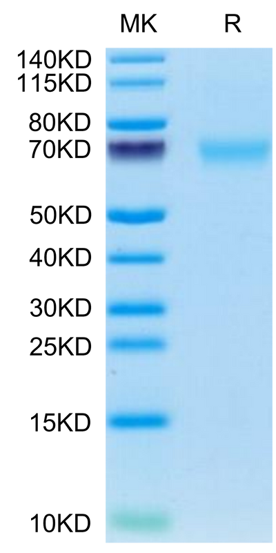 Cynomolgus AXL on Tris-Bis PAGE under reduced condition. The purity is greater than 95%.Recombinant Cynomolgus AXL Protein, Active
