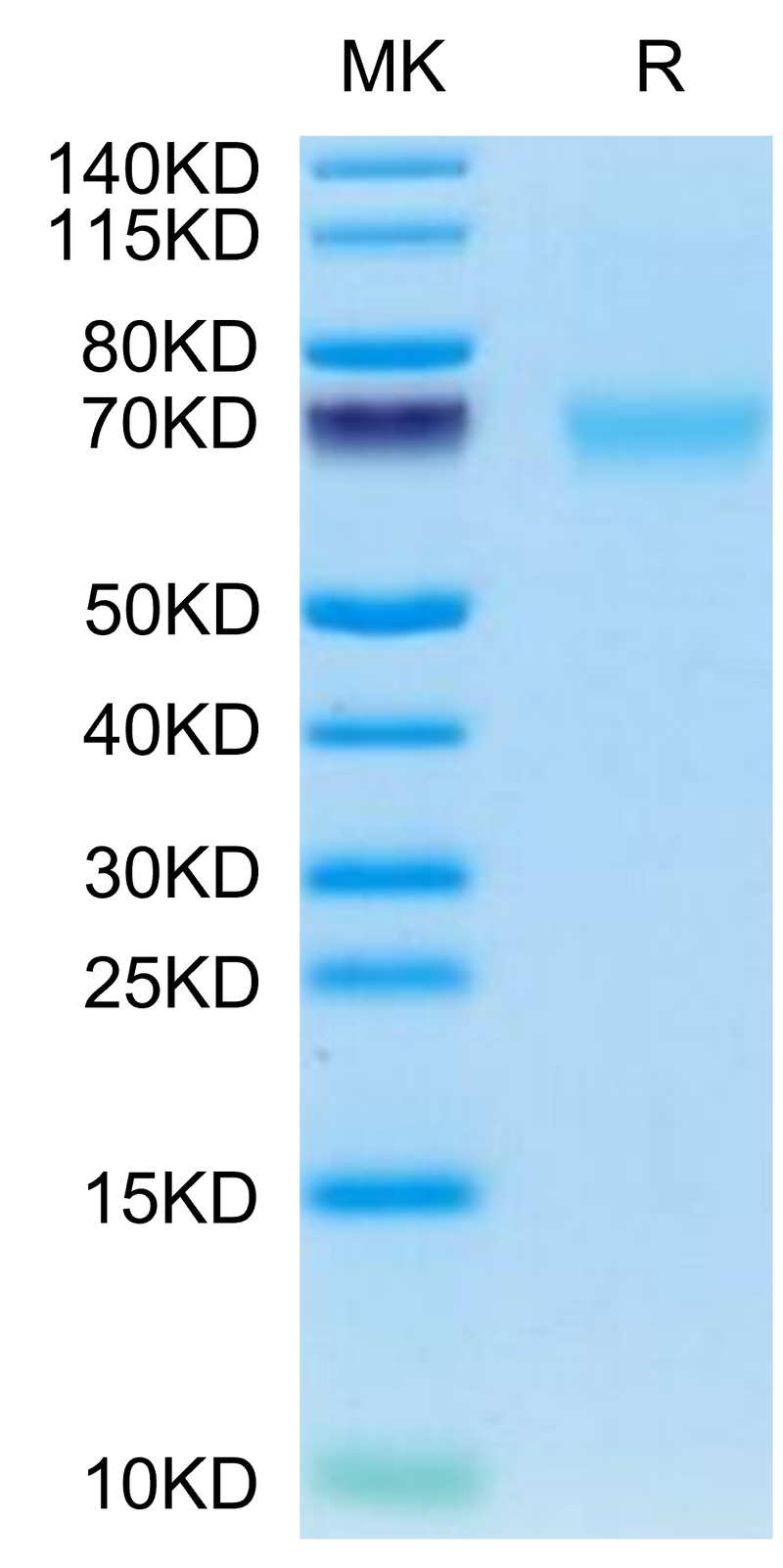 Cynomolgus AXL on Tris-Bis PAGE under reduced condition. The purity is greater than 95%.Recombinant Cynomolgus AXL Protein, Active