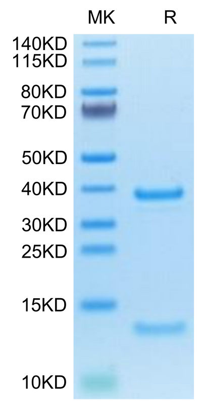 Cynomolgus/Rhesus macaque FcRn on Tris-Bis PAGE under reduced condition. The purity is greater than 95%.Recombinant Cynomolgus/Rhesus macaque FcRn Protein, Active