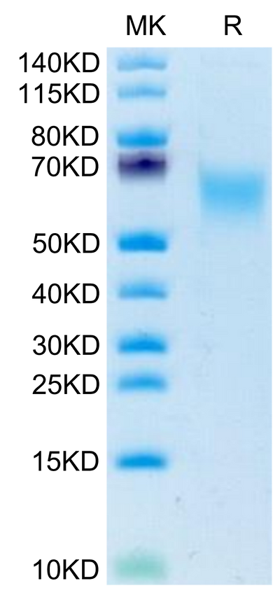 Human CADM1 on Tris-Bis PAGE under reduced condition. The purity is greater than 95%.Recombinant Human CADM1/IGSF4A Protein, Active