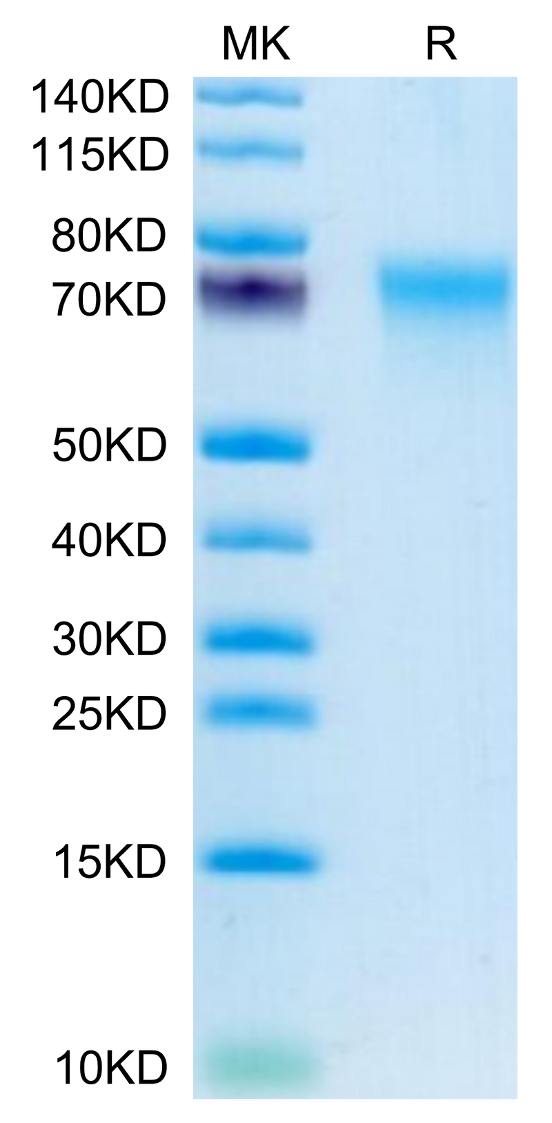 Human CD55 on Tris-Bis PAGE under reduced condition. The purity is greater than 95%.Recombinant Human CD55 Protein, Active