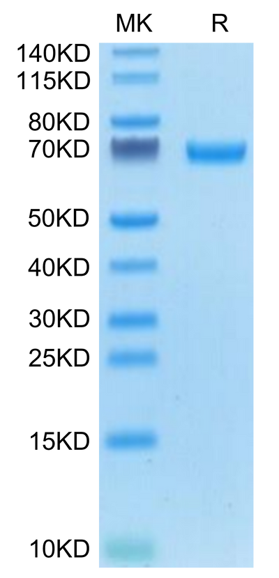 Mouse AFP on Tris-Bis PAGE under reduced condition. The purity is greater than 95%.Recombinant Mouse AFP Protein