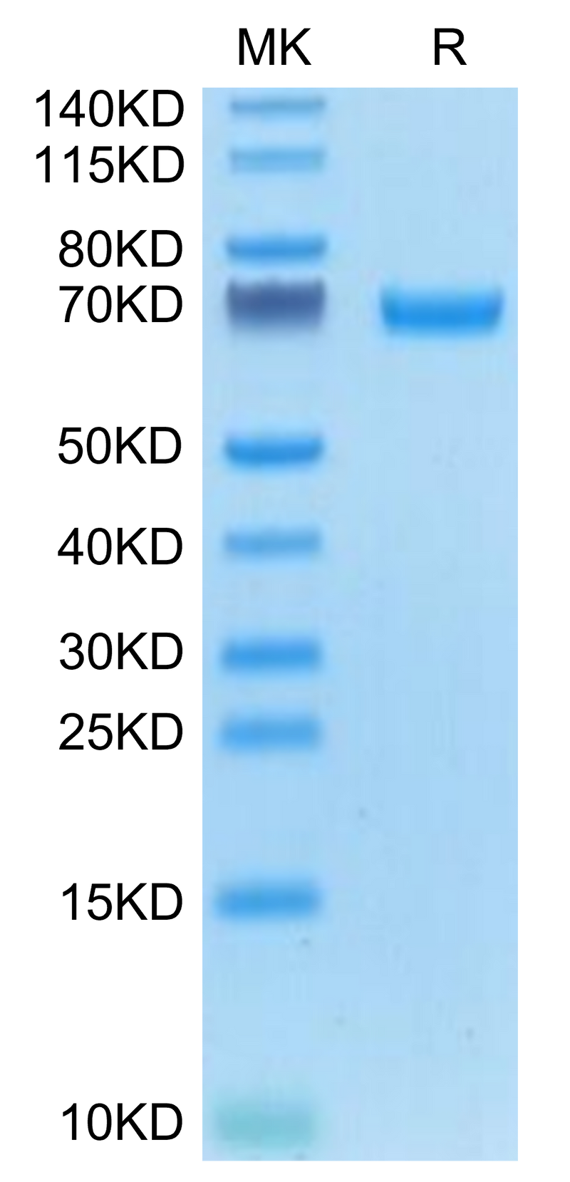 Mouse AFP on Tris-Bis PAGE under reduced condition. The purity is greater than 95%.Recombinant Mouse AFP Protein