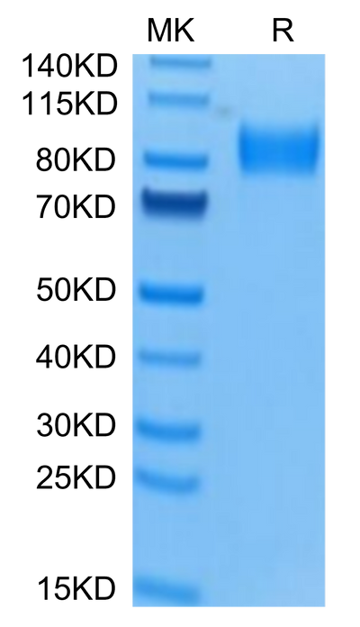 Human Osteoactivin on Tris-Bis PAGE under reduced condition. The purity is greater than 95%.Recombinant Human Osteoactivin/GPNMB Protein