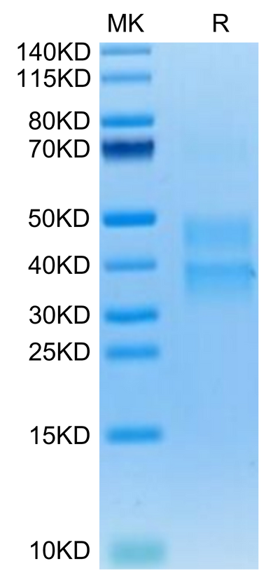 Mouse Clusterin on Tris-Bis PAGE under reduced condition. The purity is greater than 95%.Recombinant Mouse Clusterin Protein