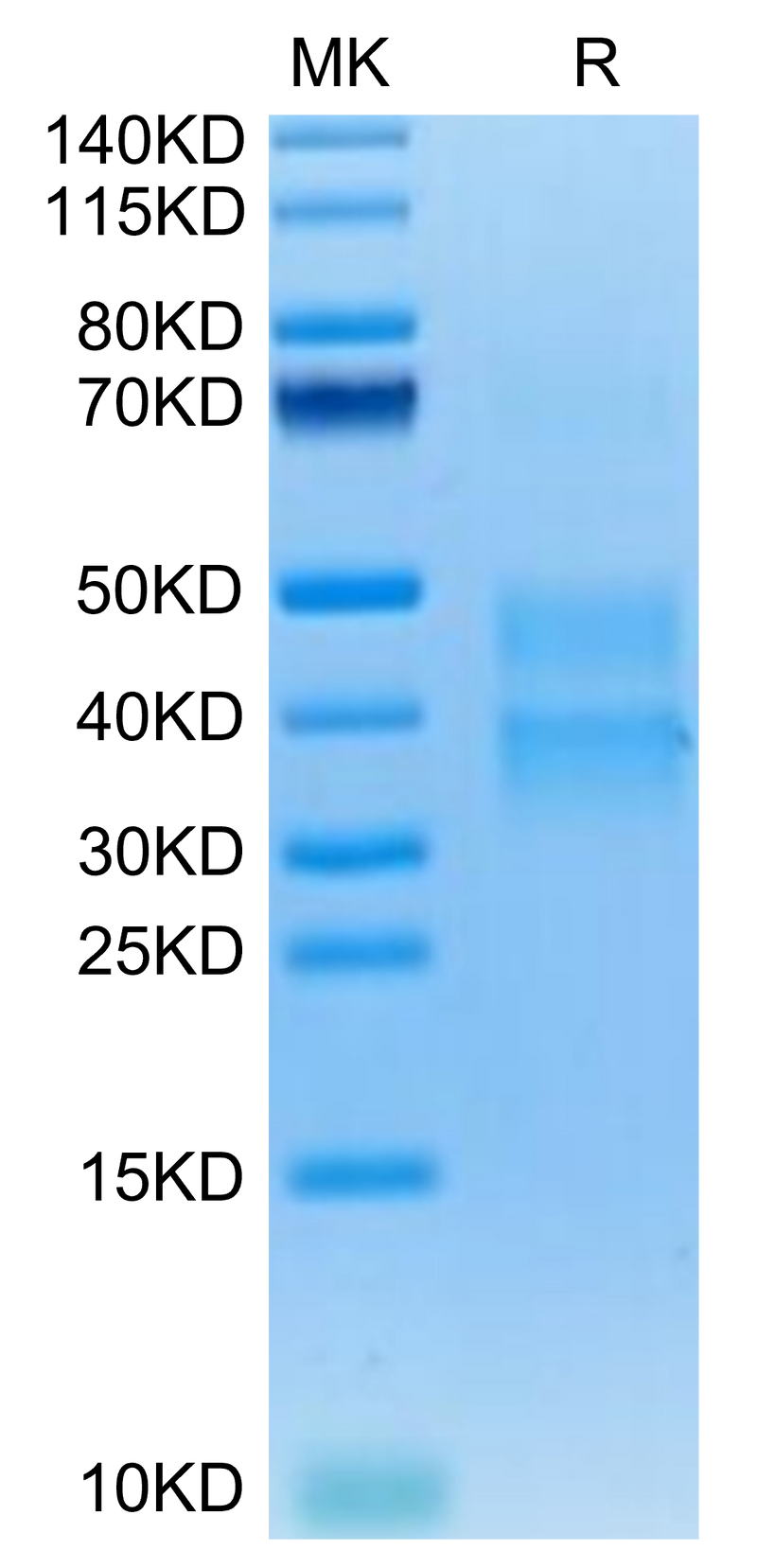 Mouse Clusterin on Tris-Bis PAGE under reduced condition. The purity is greater than 95%.Recombinant Mouse Clusterin Protein