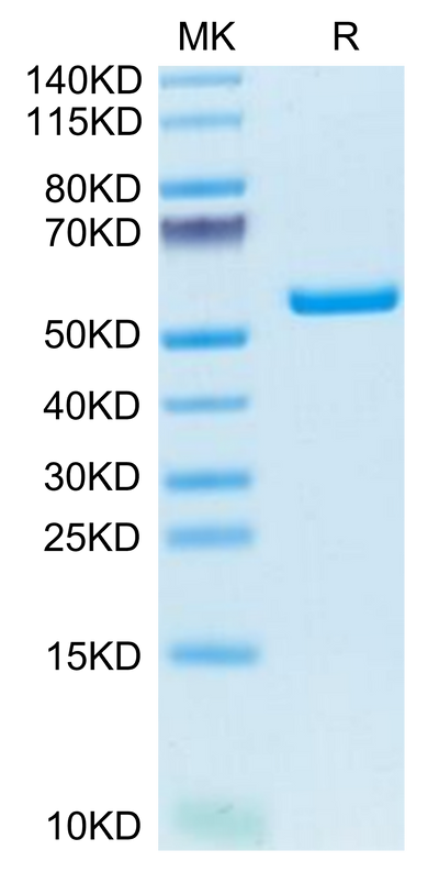 Mouse AMCase/CHIA on Tris-Bis PAGE under reduced condition. The purity is greater than 95%.Recombinant Mouse AMCase/CHIA Protein