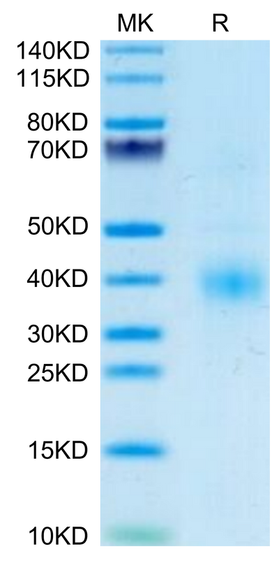 Human Clusterin on Tris-Bis PAGE under reduced condition. The purity is greater than 95%.Recombinant Human Clusterin Protein, Active