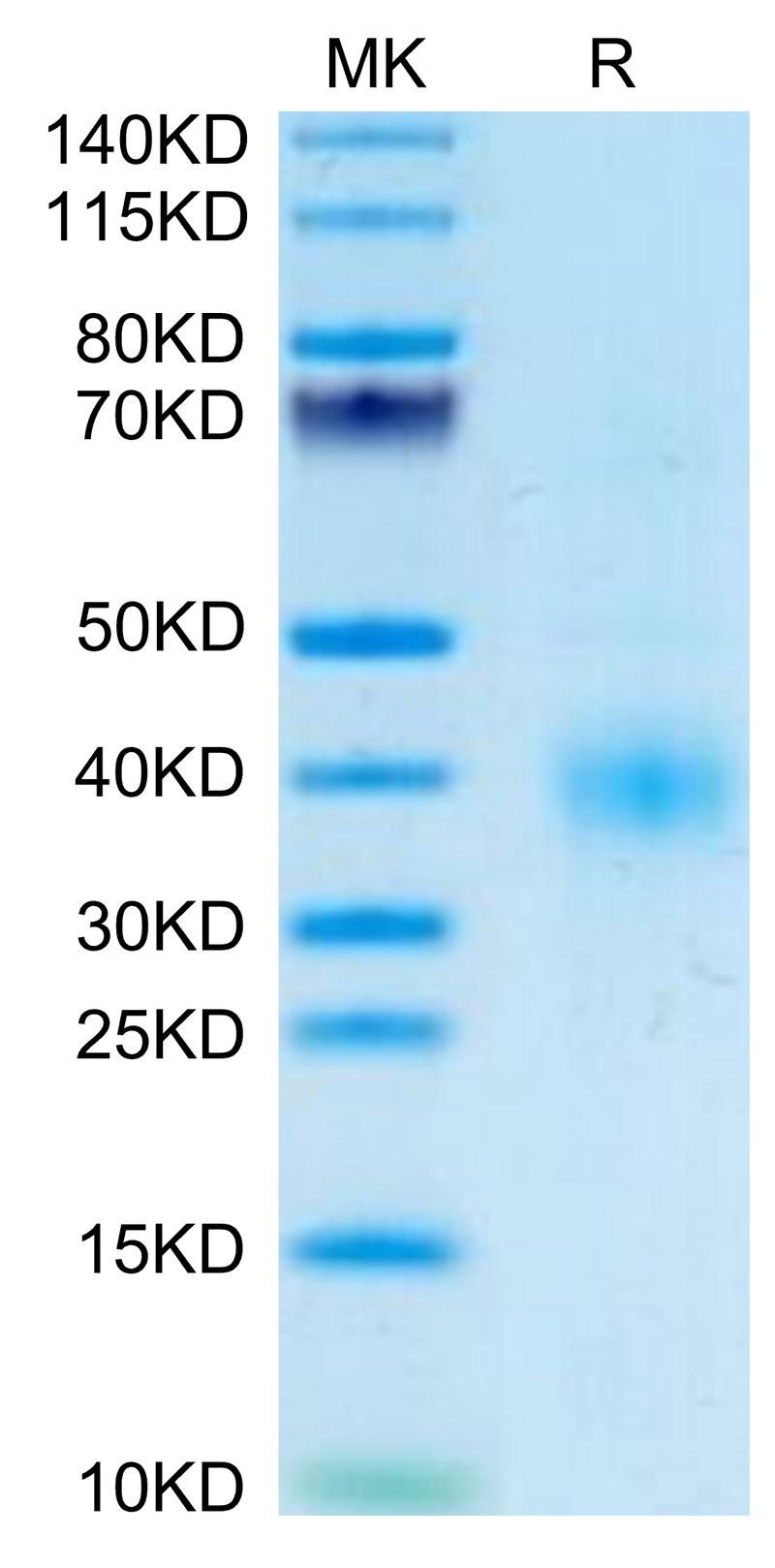 Human Clusterin on Tris-Bis PAGE under reduced condition. The purity is greater than 95%.Recombinant Human Clusterin Protein, Active
