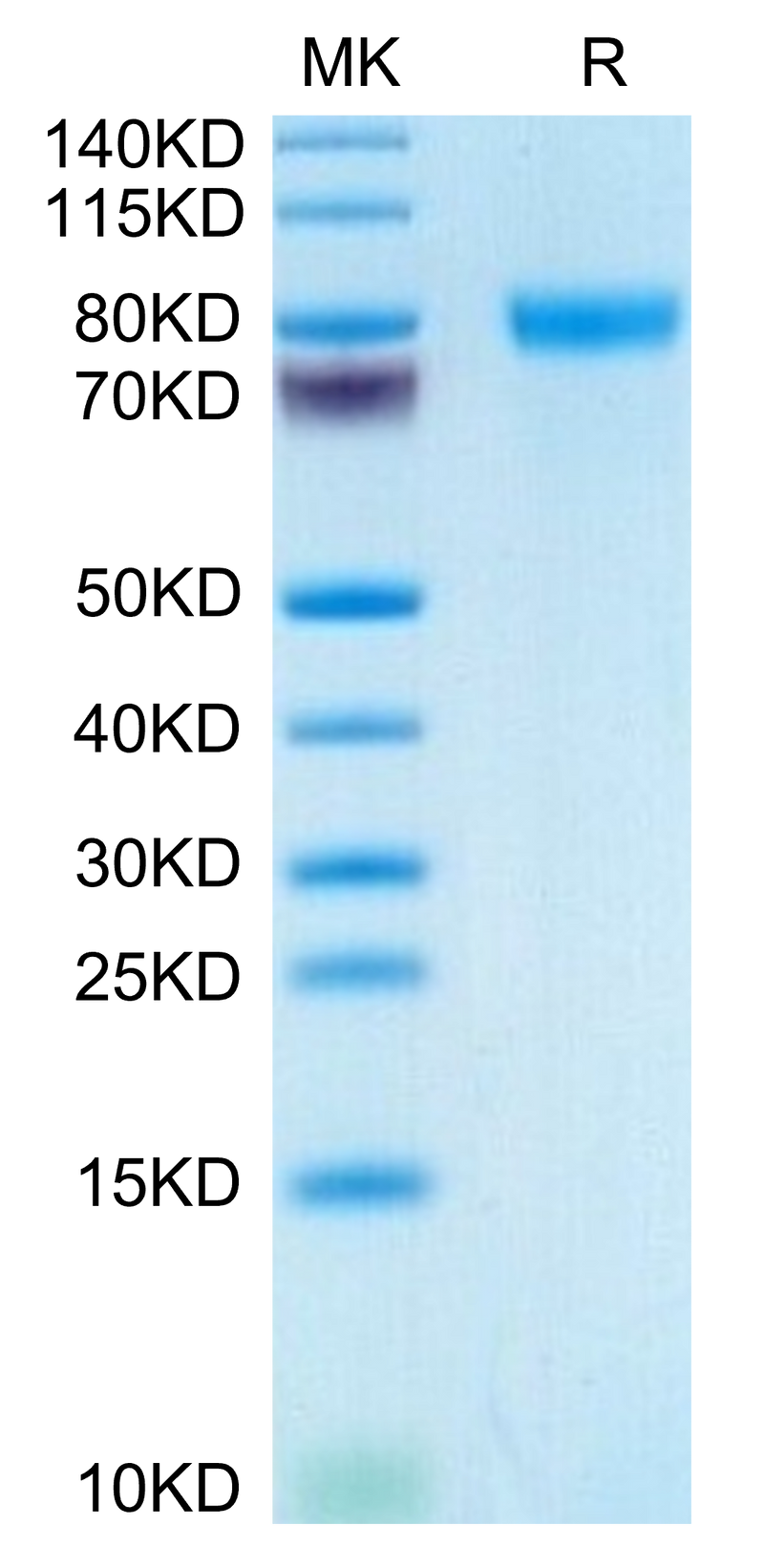 Human GEP on Tris-Bis PAGE under reduced condition. The purity is greater than 95%.Recombinant Human GEP Protein