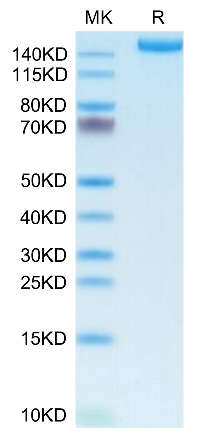 Human L1CAM on Tris-Bis PAGE under reduced condition. The purity is greater than 95%.Recombinant Human L1CAM Protein, Active