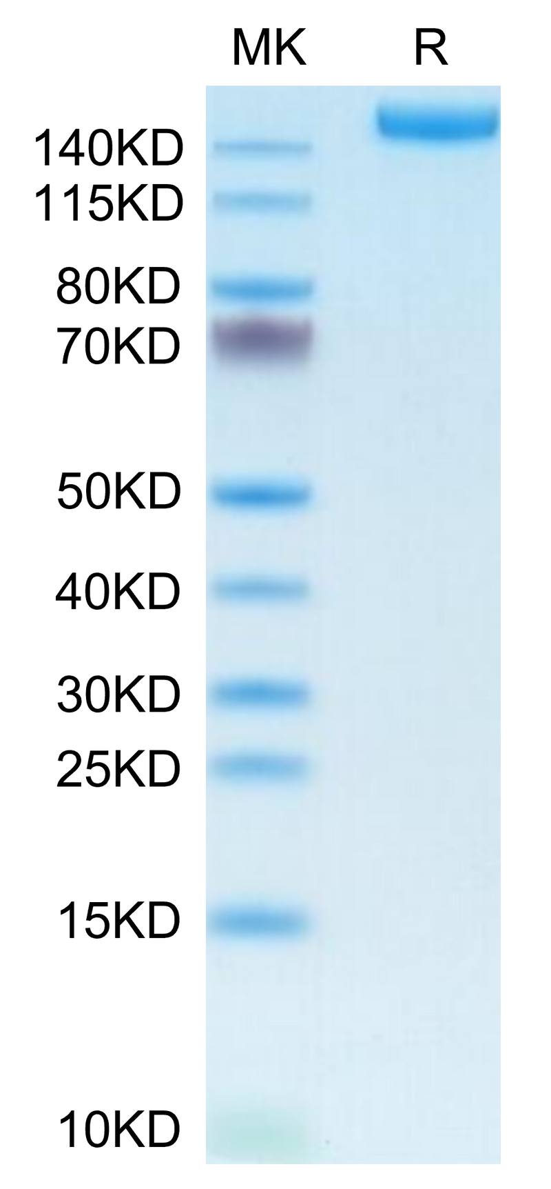Human L1CAM on Tris-Bis PAGE under reduced condition. The purity is greater than 95%.