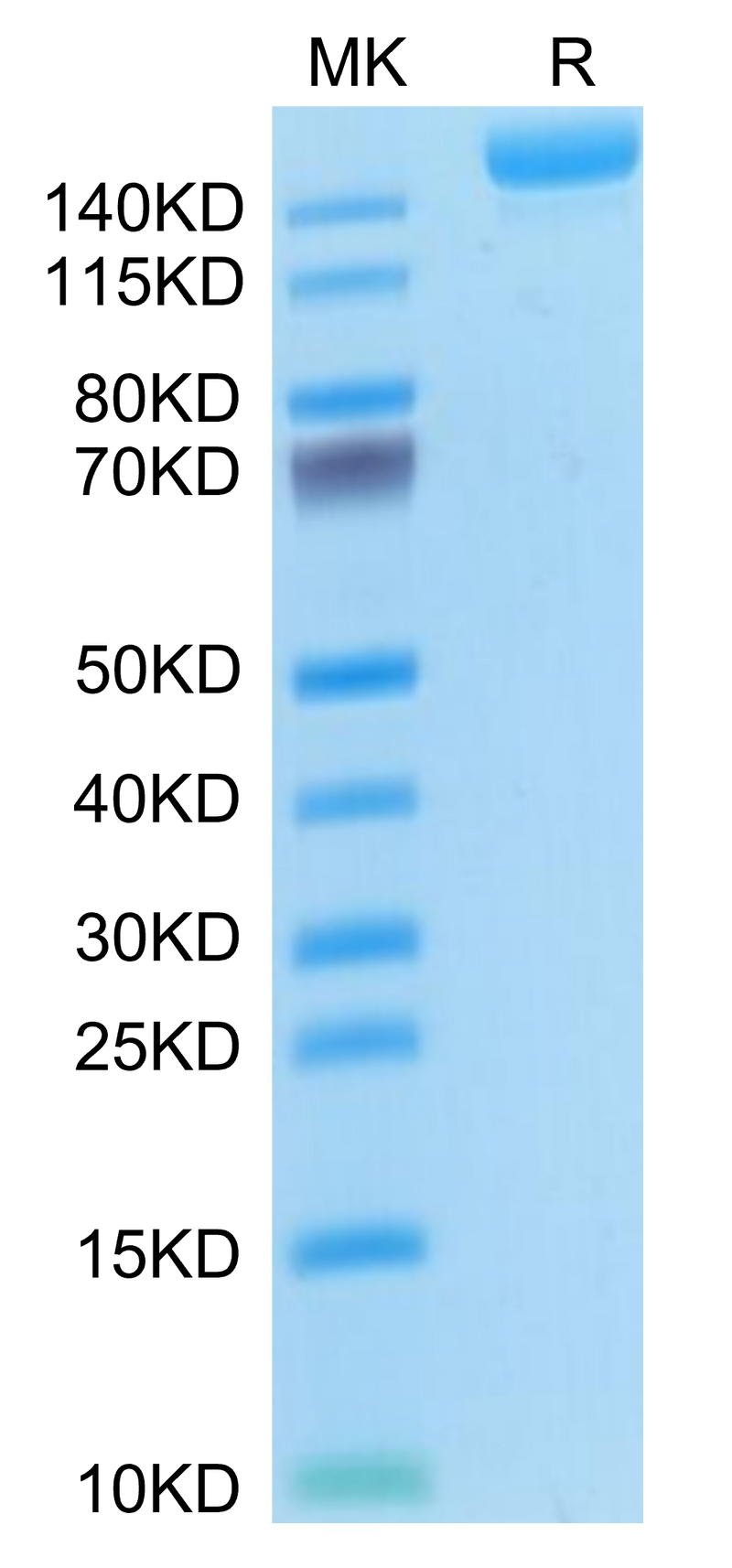 Mouse L1CAM on Tris-Bis PAGE under reduced condition. The purity is greater than 95%.Recombinant Mouse L1CAM Protein