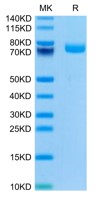 Mouse EPHA3 on Tris-Bis PAGE under reduced condition. The purity is greater than 95%.Recombinant Mouse EPHA3 Protein