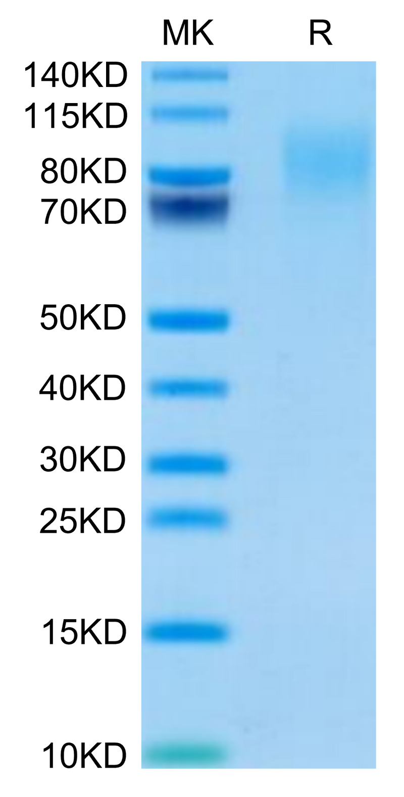 Mouse CEACAM-1/CD66a on Tris-Bis PAGE under reduced condition. The purity is greater than 95%.Recombinant Mouse CEACAM-1/CD66a Protein