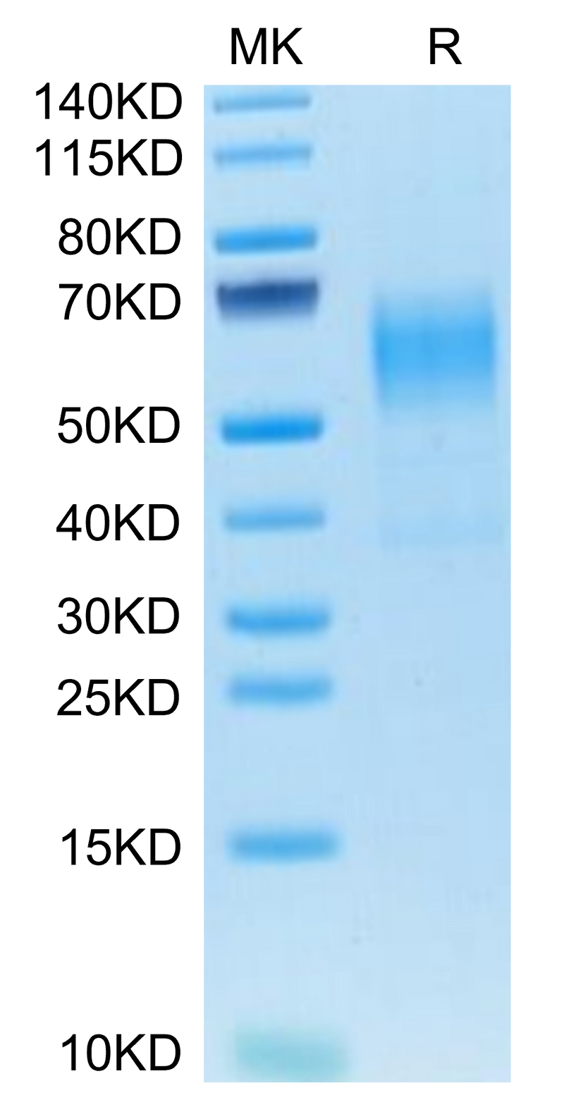 Mouse CD19 on Tris-Bis PAGE under reduced condition. The purity is greater than 90%.Recombinant Mouse CD19 Protein