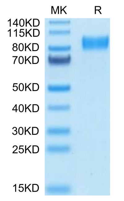 Mouse Osteoactivin on Tris-Bis PAGE under reduced condition. The purity is greater than 95%.Recombinant Mouse Osteoactivin/GPNMB Protein