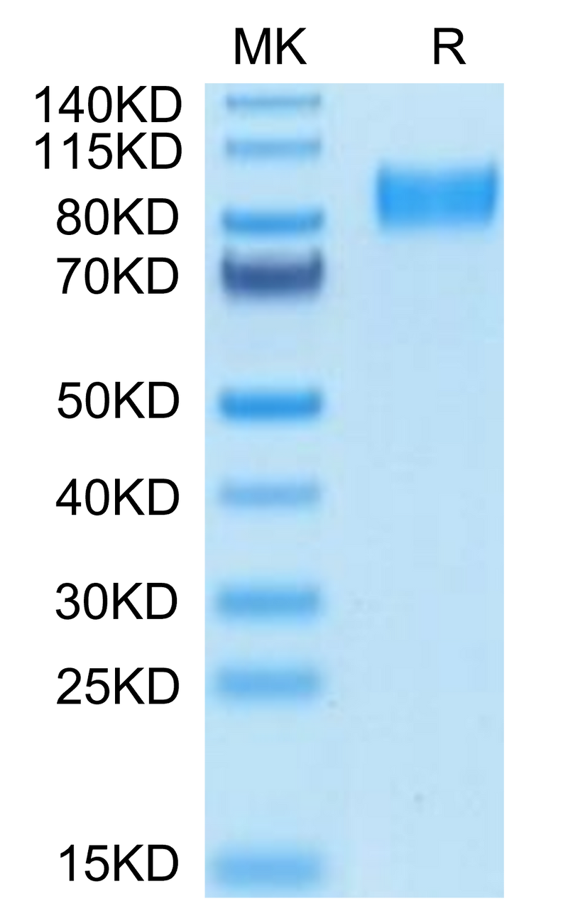 Mouse Osteoactivin on Tris-Bis PAGE under reduced condition. The purity is greater than 95%.Recombinant Mouse Osteoactivin/GPNMB Protein