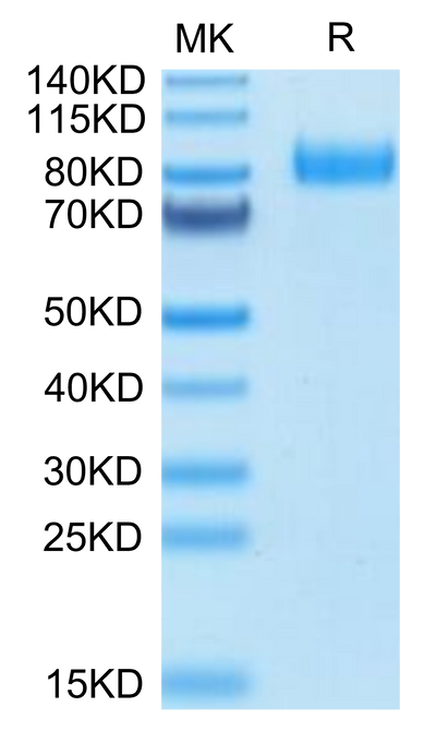 Human B7-H7 on Tris-Bis PAGE under reduced condition. The purity is greater than 95%.Recombinant Human B7-H7/HHLA2 Protein, Active