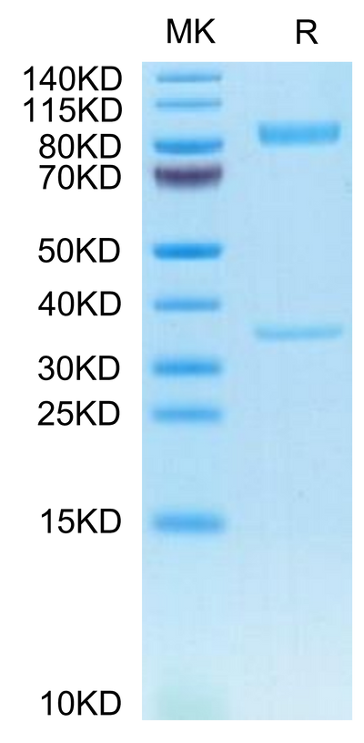 Human BACE-1 on Tris-Bis PAGE under reduced condition. The purity is greater than 95%.Recombinant Human BACE-1 Protein