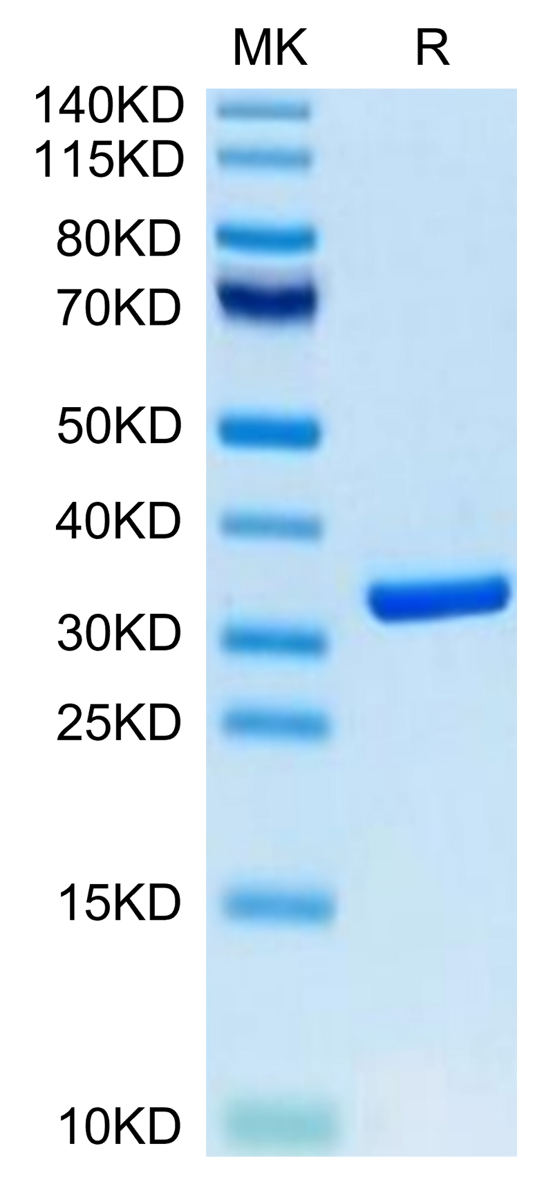 Biotinylated Human HMGB1 on Tris-Bis PAGE under reduced condition. The purity is greater than 95%.Biotinylated Human HMGB1 Protein (Primary Amine Labeling)