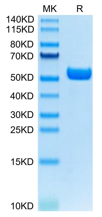 Human HLA-A*11:01&B2M&KRAS G12D (VVVGADGVGK) Monomer on Tris-Bis PAGE under reduced condition. The purity is greater than 95%.Recombinant Human HLA-A*11:01&B2M&KRAS G12D (VVVGADGVGK) Monomer Protein, Active