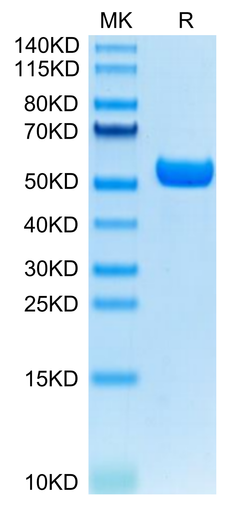 Human HLA-A*11:01&B2M&KRAS G12D (VVVGADGVGK) Monomer on Tris-Bis PAGE under reduced condition. The purity is greater than 95%.Recombinant Human HLA-A*11:01&B2M&KRAS G12D (VVVGADGVGK) Monomer Protein, Active