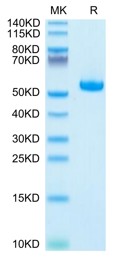 Human HLA-A*11:01&B2M&KRAS G12V (VVVGAVGVGK) Monomer on Tris-Bis PAGE under reduced condition. The purity is greater than 95%.Recombinant Human HLA-A*11:01&B2M&KRAS G12V (VVVGAVGVGK) Monomer Protein