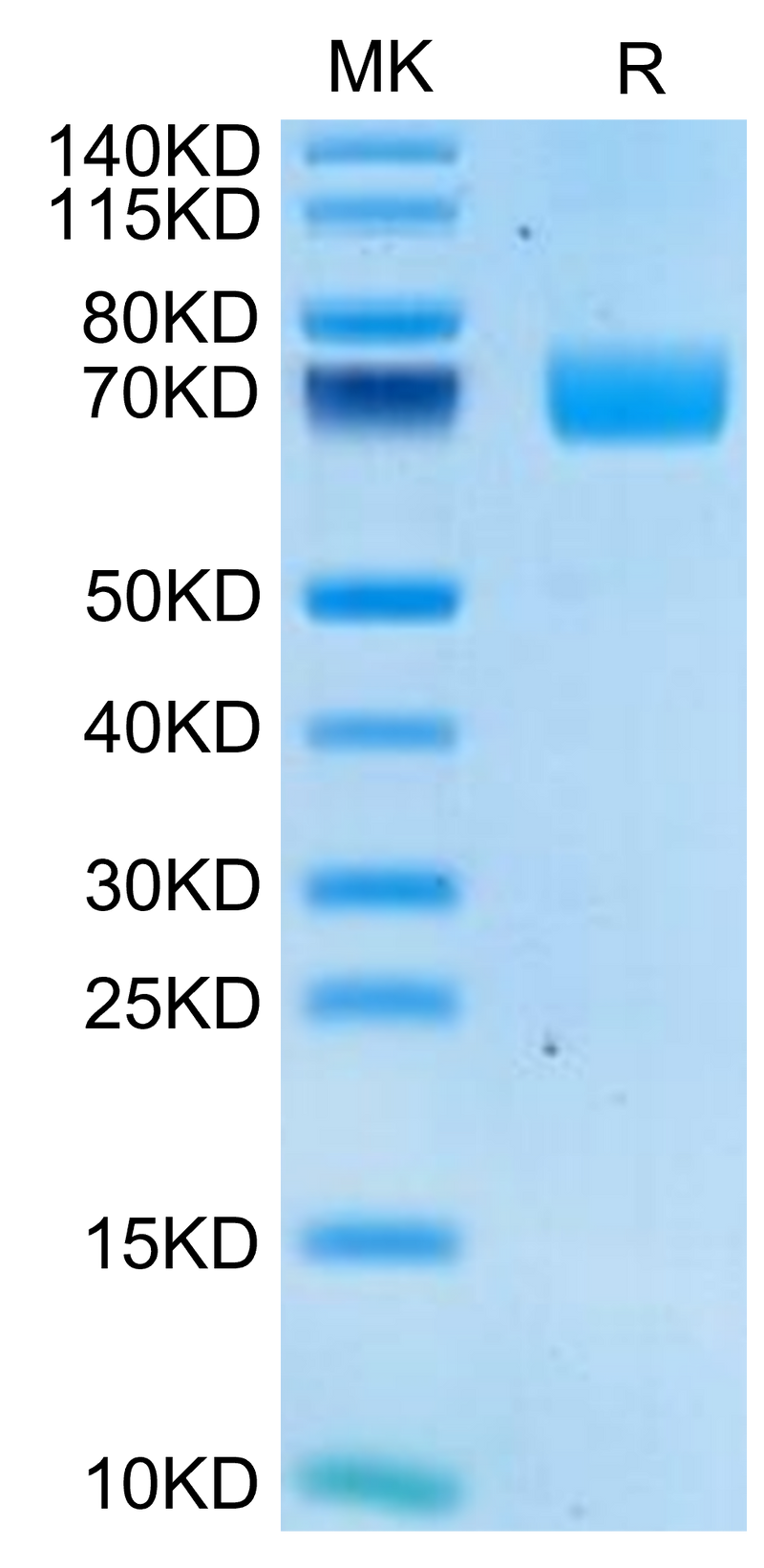 Human 2B4 on Tris-Bis PAGE under reduced condition. The purity is greater than 95%.Recombinant Human 2B4/CD244/SLAMF4 Protein, Active