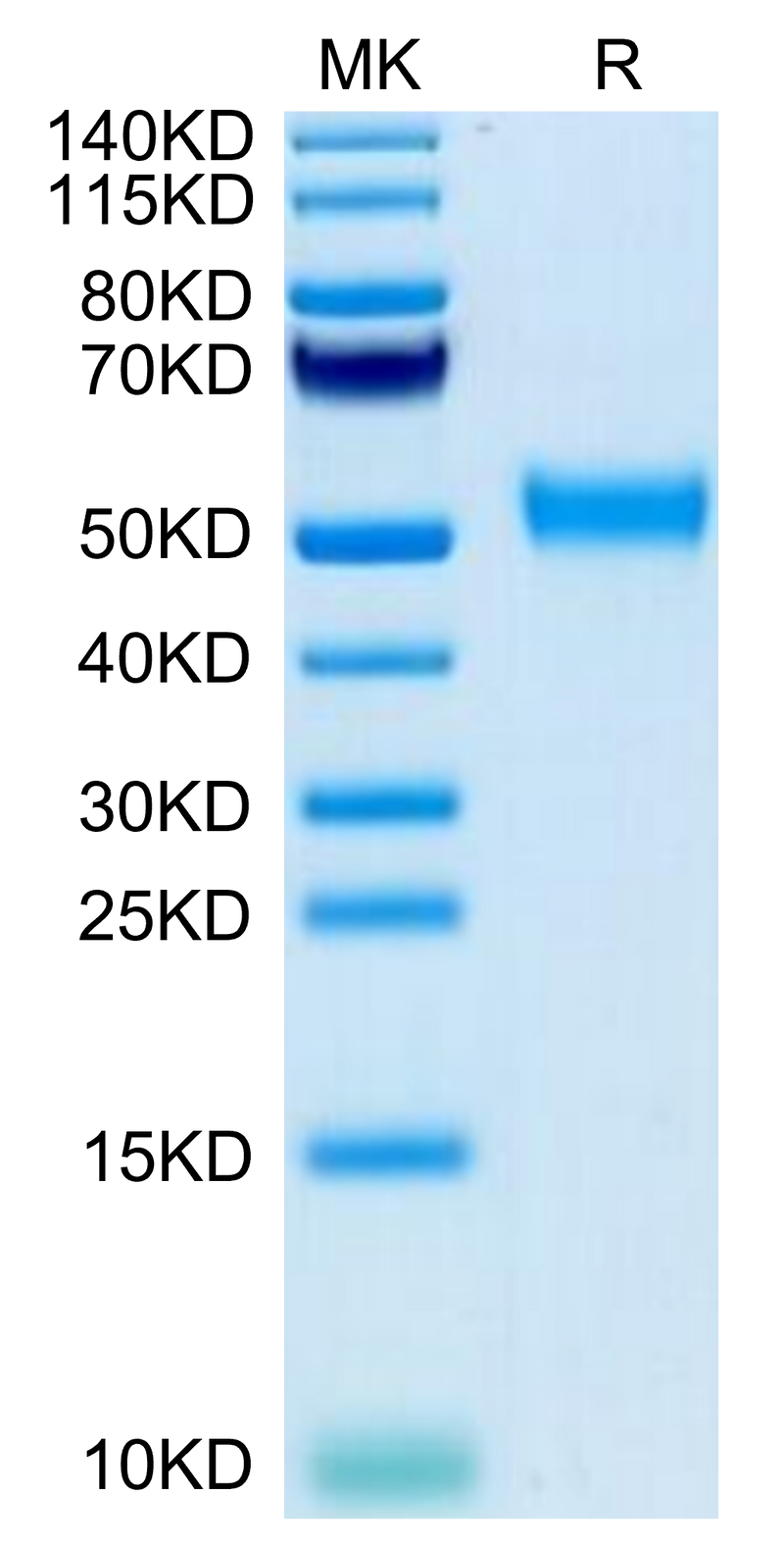 Biotinylated Cynomolgus CD24 on Tris-Bis PAGE under reduced condition. The purity is greater than 95%.Biotinylated Cynomolgus CD24 Protein (Primary Amine Labeling)