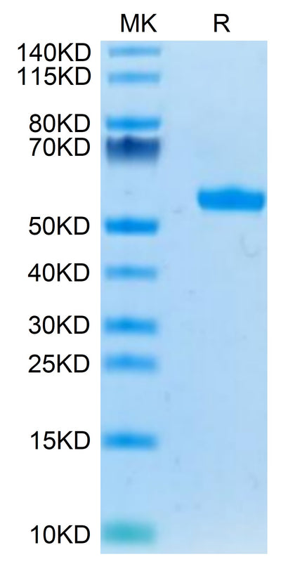 Human HLA-A*03:01&B2M&KRAS G12V (VVVGAVGVGK) Monomer on Tris-Bis PAGE under reduced condition. The purity is greater than 95%.Recombinant Human HLA-A*03:01&B2M&KRAS G12V (VVVGAVGVGK) Monomer Protein, Active