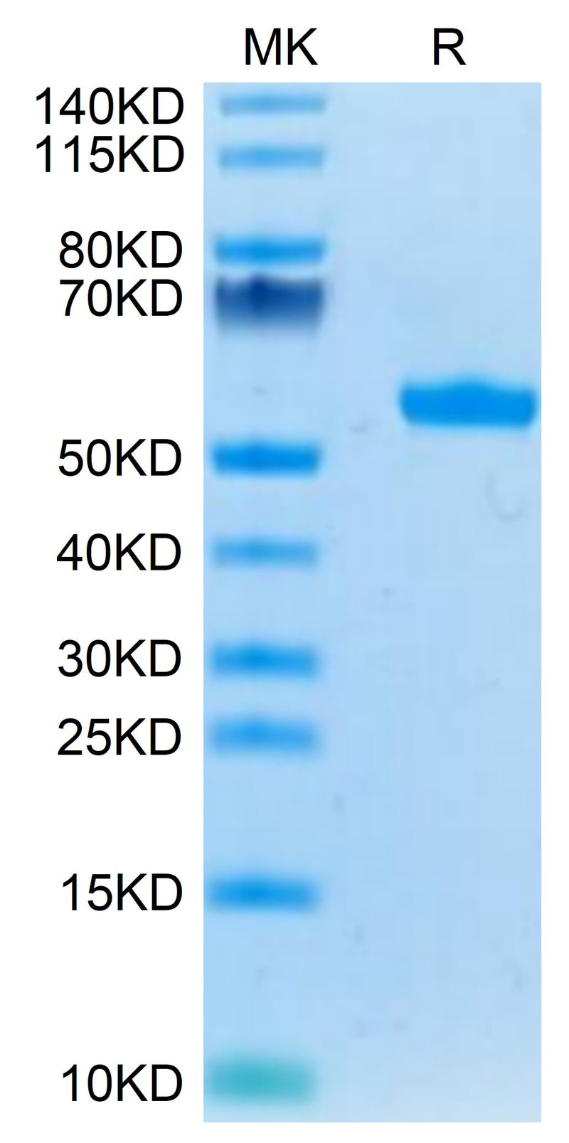 Human HLA-A*03:01&B2M&KRAS G12V (VVVGAVGVGK) Monomer on Tris-Bis PAGE under reduced condition. The purity is greater than 95%.Recombinant Human HLA-A*03:01&B2M&KRAS G12V (VVVGAVGVGK) Monomer Protein, Active