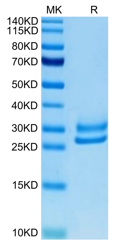 Human IL-15RA&IL-15 on Tris-Bis PAGE under reduced condition. The purity is greater than 95%.Recombinant Human IL-15RA&IL-15 Protein, Active